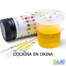 Cuanto Dura La Cocaina En Orina